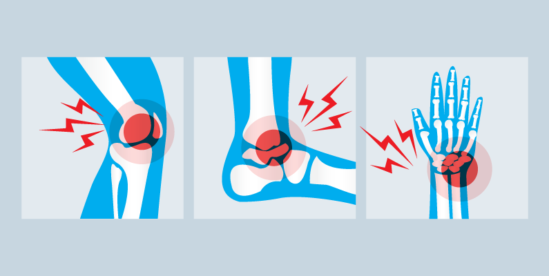 Graphic of ankle injury