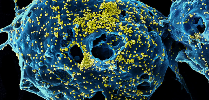 Corona Virus microscopic view.