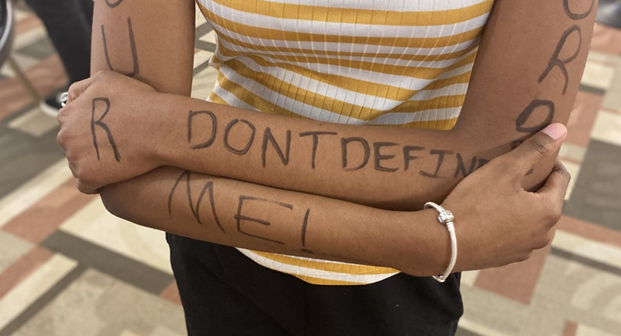 Arms with marked words around them in black marker.